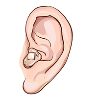 Different types of hearing devices at  Dr. Pradhan's Hearing Aid center in Thane