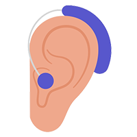 Different types of hearing devices at  Dr. Pradhan's Hearing Aid center - receiver in canal